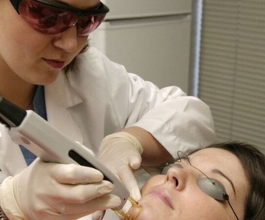 Ласерска процедура за подмладување на кожата на лицето